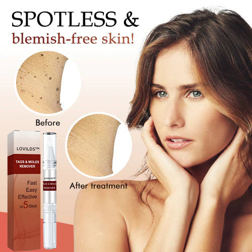 A targeted serum that helps visibly reduce the look of dark spots and refine uneven texture with gentle brighteners and exfoliants