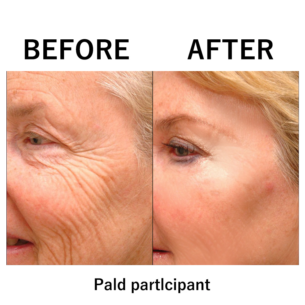 FirmFlash™ | Instant Temporary Face Tightening Cream