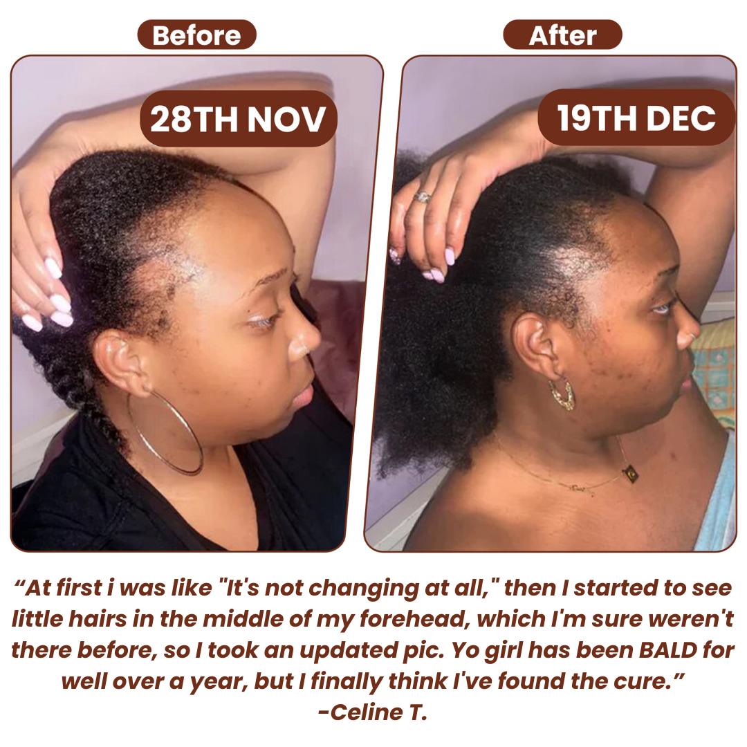 Batanique Batana Oil – 100% Unrefined Hair Oil