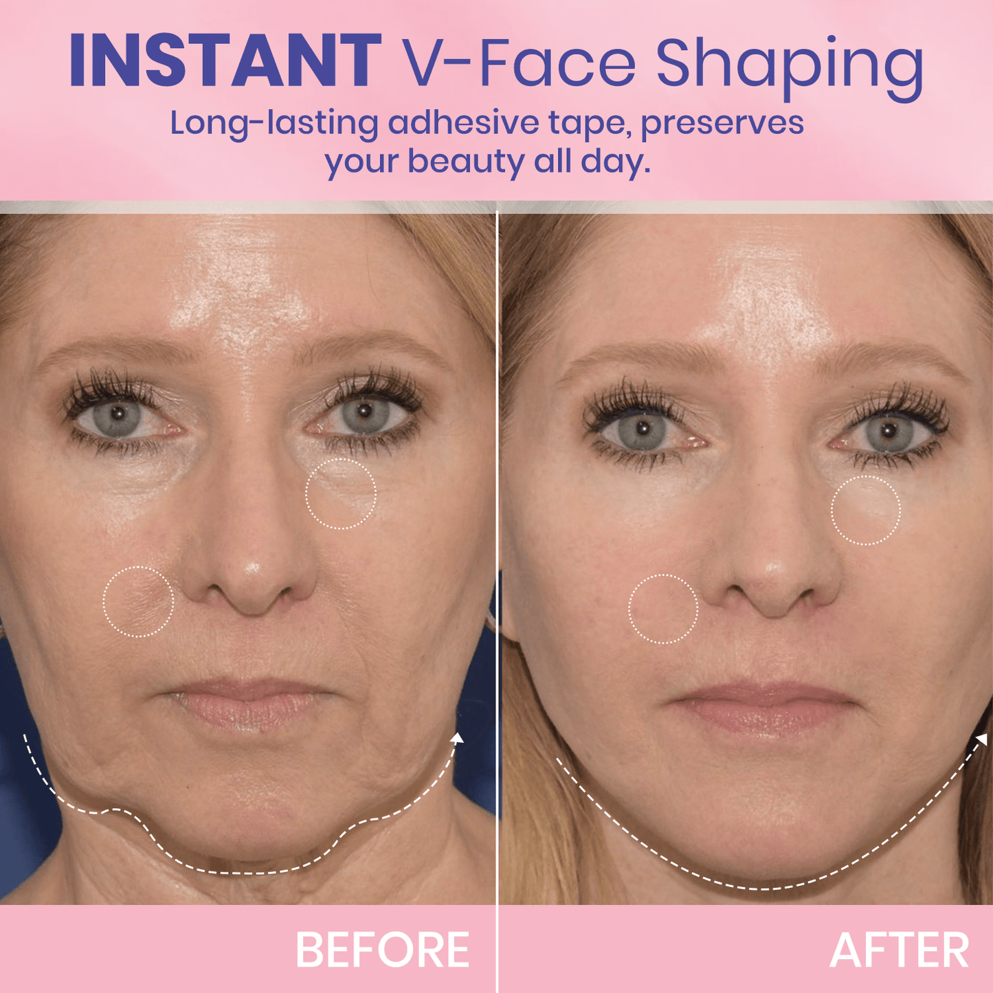 InvisiLift invisible face-lifting tape