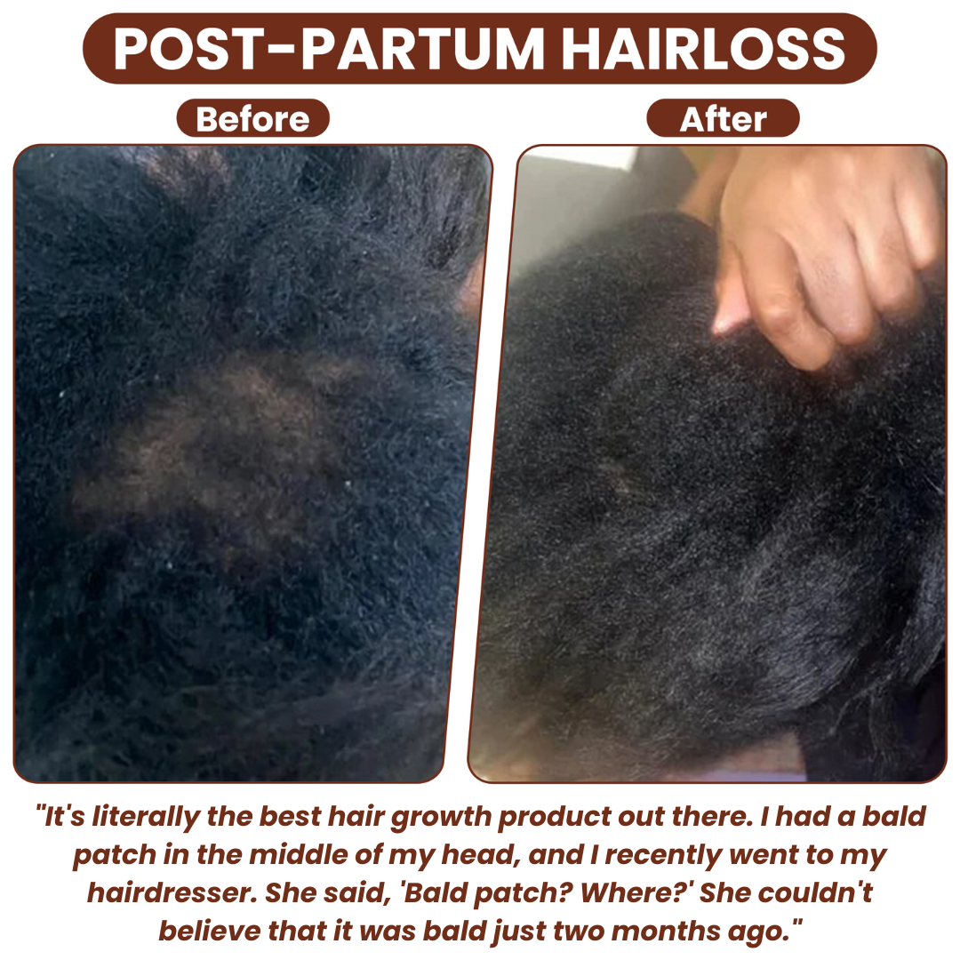 Batanique Batana Oil – 100% Unrefined Hair Oil