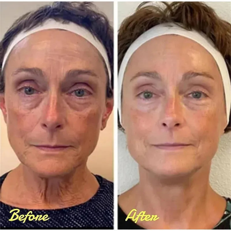 Callouts: removes look of under-eye puffiness, reduces appearance of wrinkles, moisturizes, soothes—Dead Sea minerals