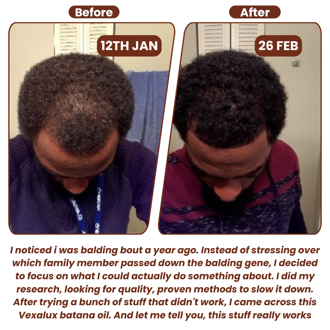 Batanique Batana Oil – 100% Unrefined Hair Oil
