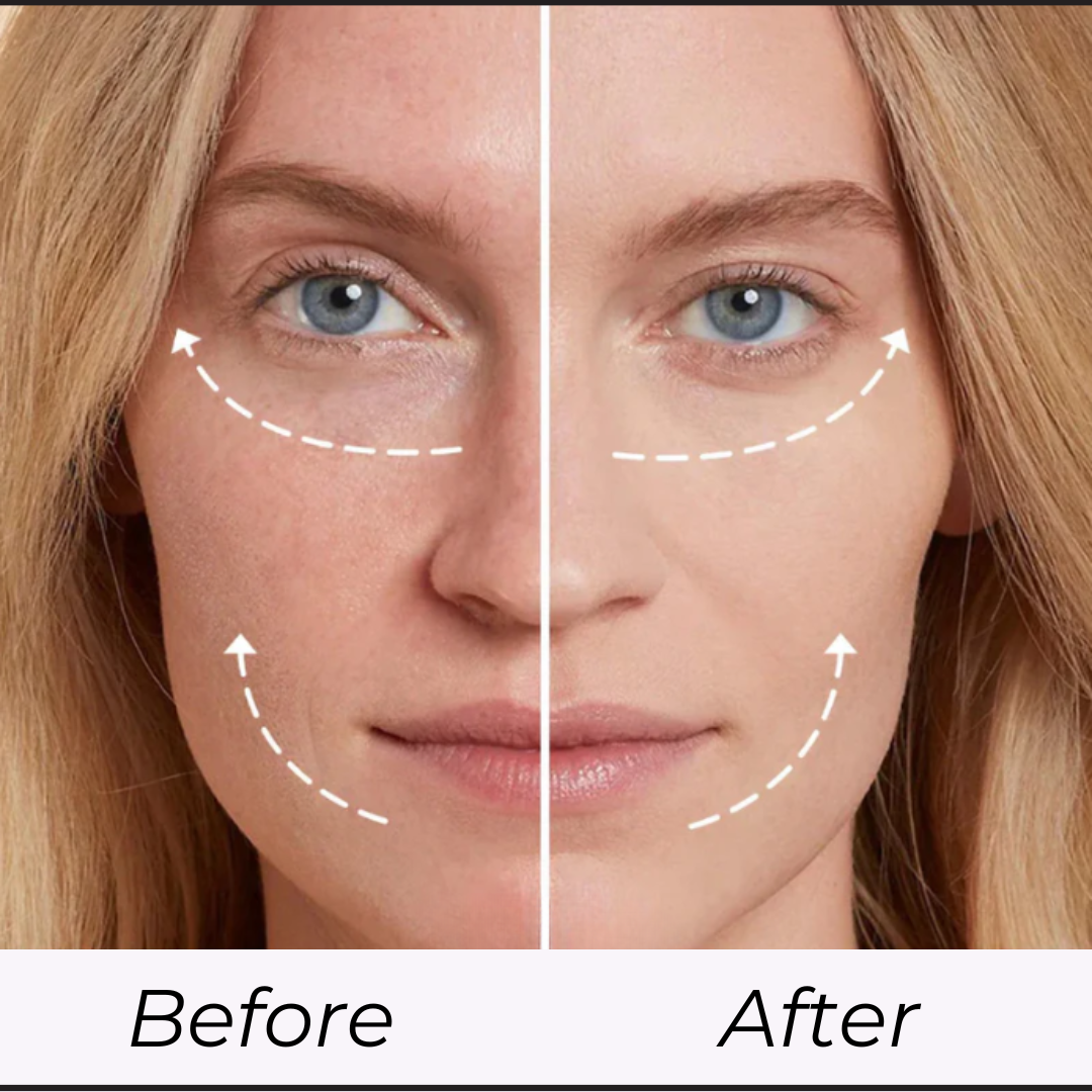 Before and after comparison of a woman's face with visible skin texture differences.