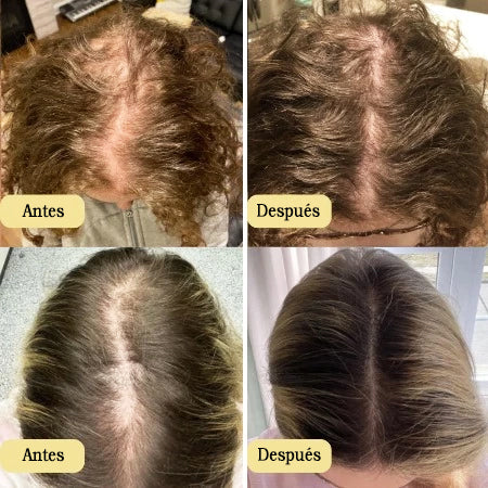 Before/after appearance of fuller-looking hair after routine use