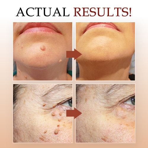 A targeted serum that helps visibly reduce the look of dark spots and refine uneven texture with gentle brighteners and exfoliants