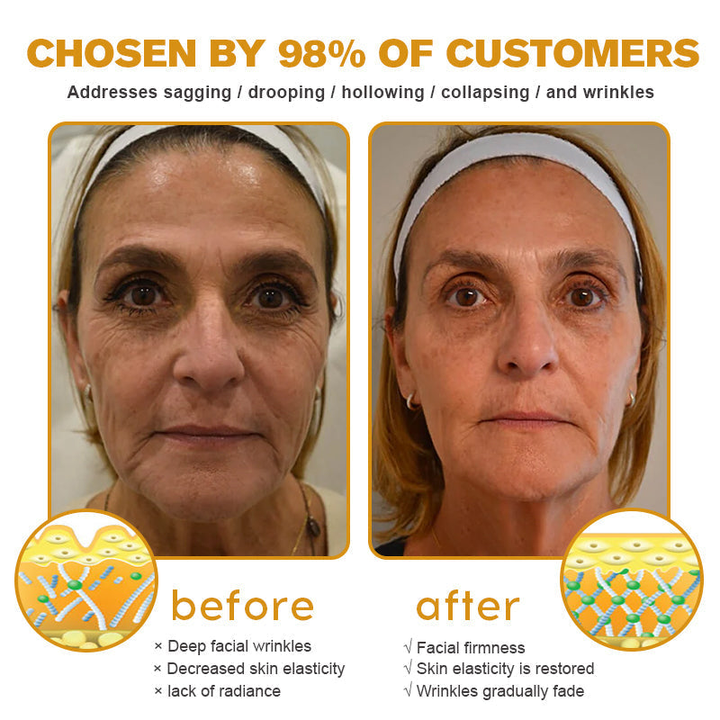 Crema BeeBotox | Bee Venom Line-Smoothing Face Cream