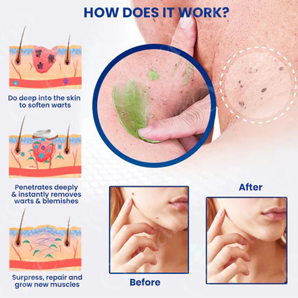 Applying NatureErase gel to targeted area on clean skin