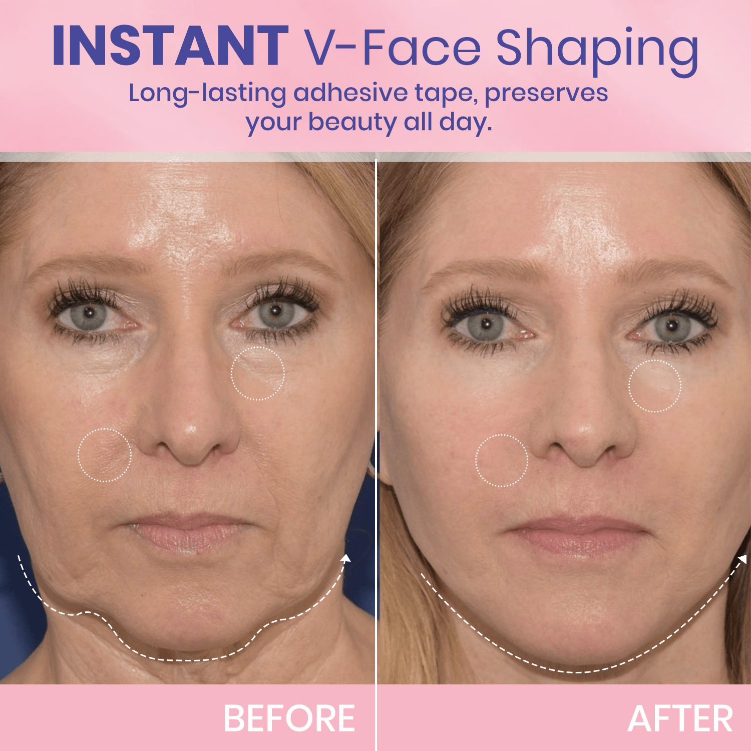 InvisiLift invisible face-lifting tape