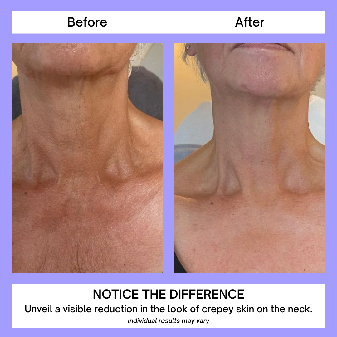 NovoNeck | Lift & Firm Neck Cream
