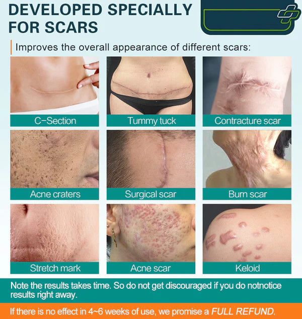 CicaCell scar-appearance smoothing spray bottle with fine mist