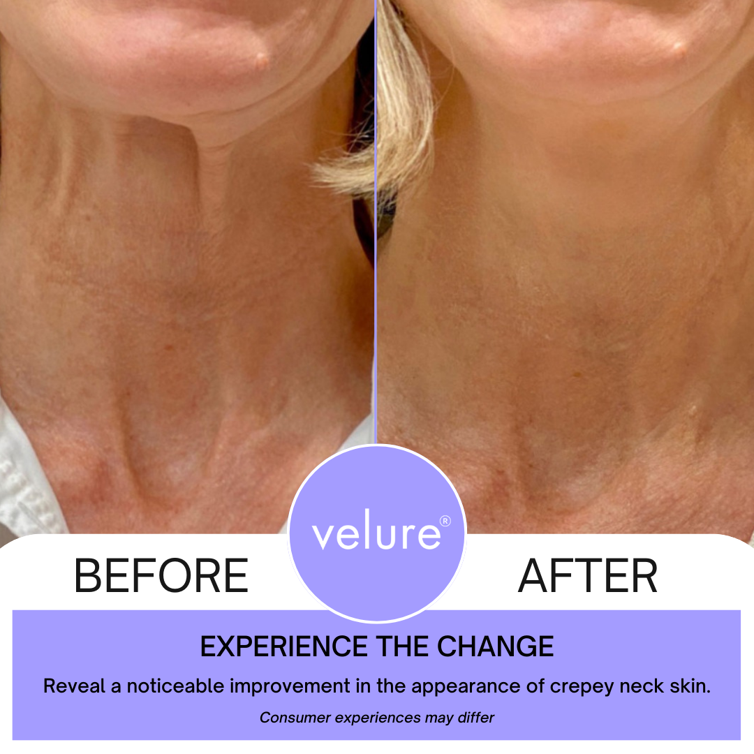 NovoNeck | Lift & Firm Neck Cream