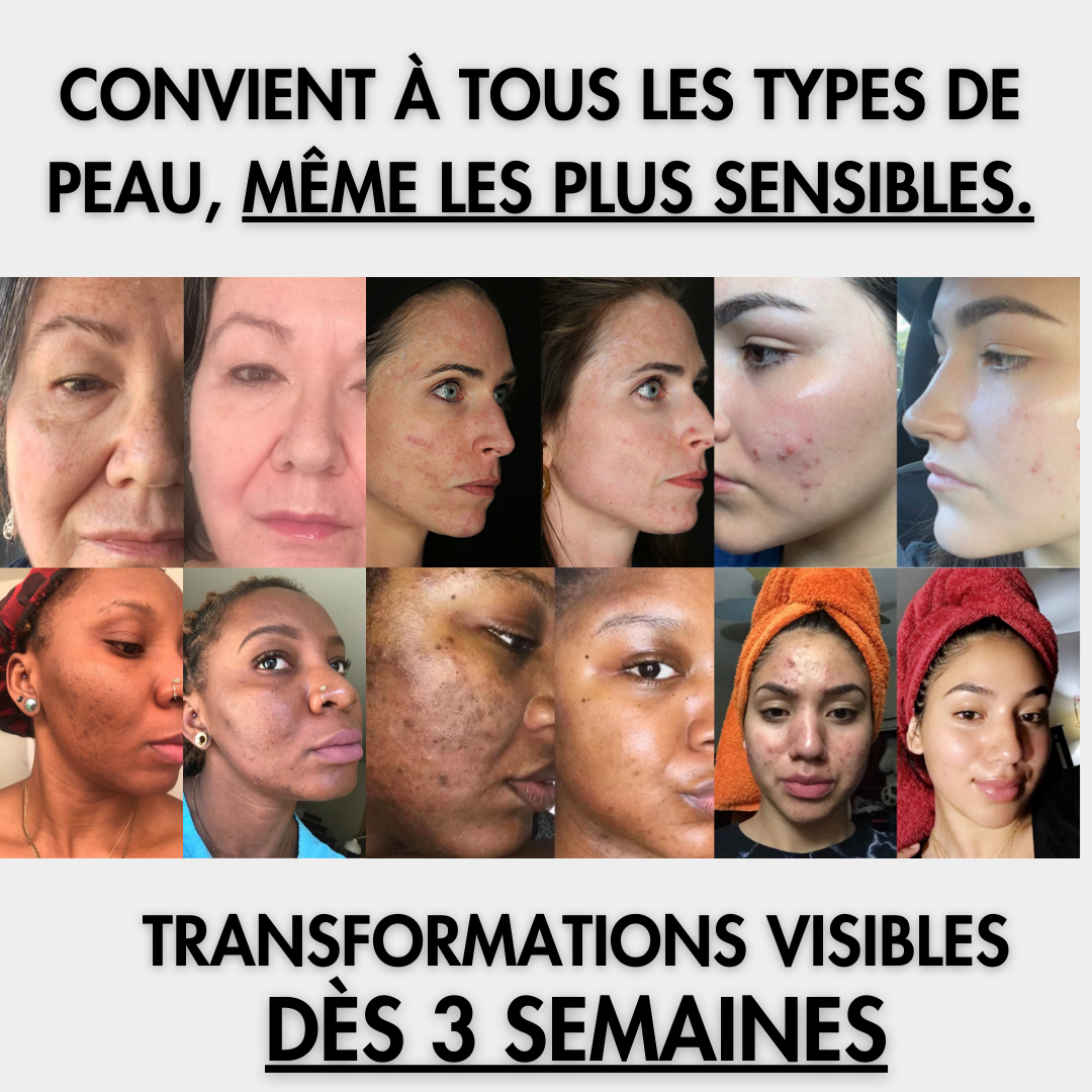 Cotons Glow Up™ | Turmeric + Kojic Brightening Exfoliating Pads