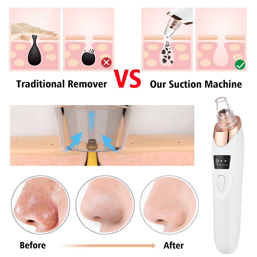 PoreLift Pro five replaceable suction heads for different skin needs