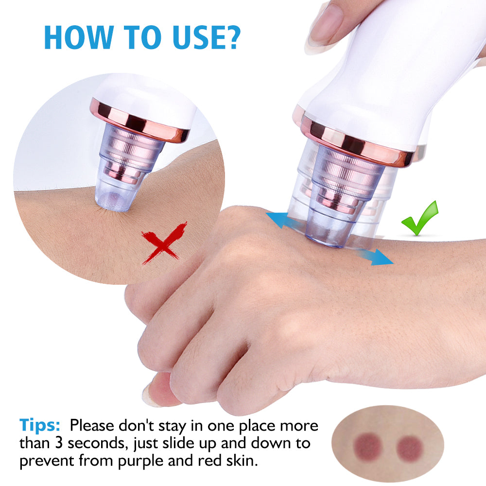 PoreLift Pro five replaceable suction heads for different skin needs