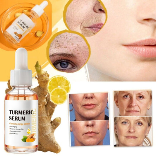 NiaTurm turmeric and niacinamide dark spot serum bottle with dropper