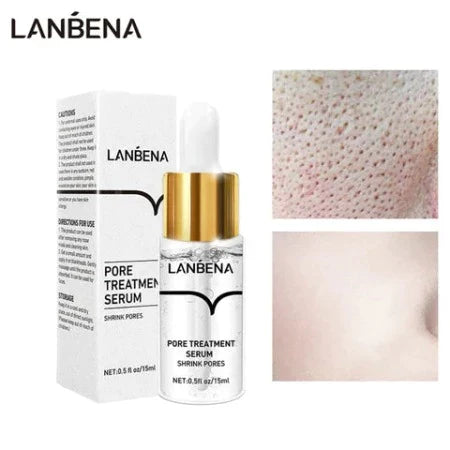 LANBENA pore treatment serum with packaging and skin before and after treatment on a white background
